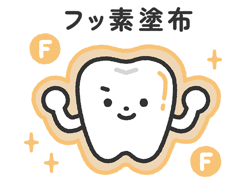 フッ素塗布